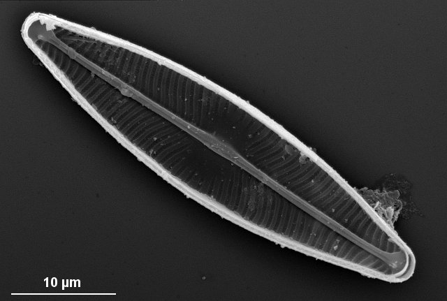 Navicula lanceolata (inside view)